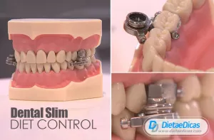 dentalslim diet control Ilustração de dentalslim diet control